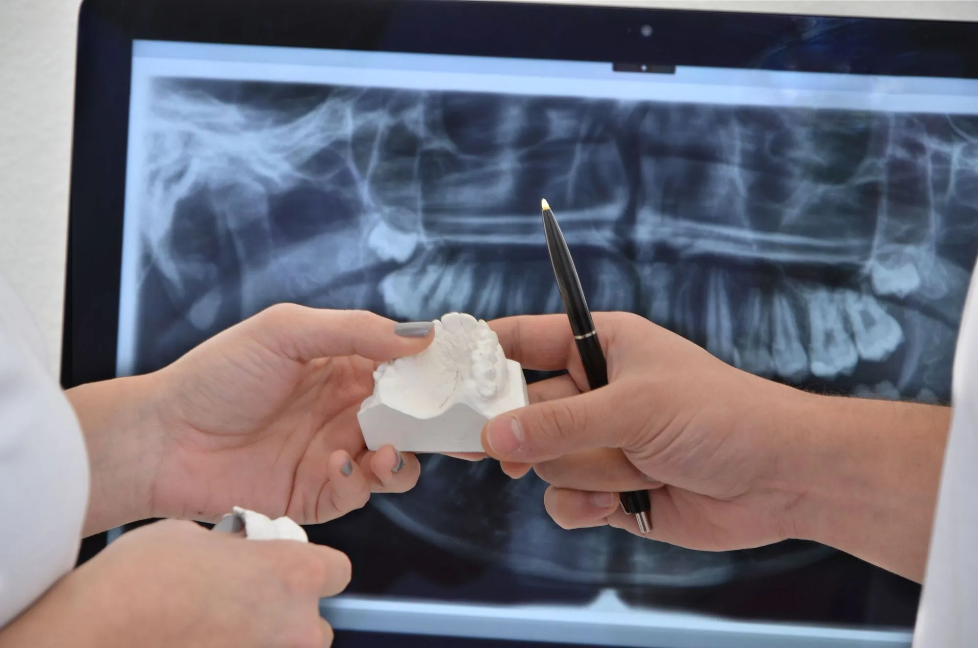 Kieferorthopädische Beratung mit Modell eines Zahnabdrucks vor digitaler Röntgenaufnahme